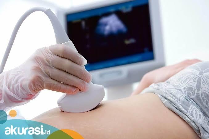 Jangan Diabaikan, Ini Pentingnya Pemeriksaan USG saat Kehamilan